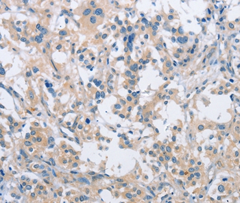 SH3GLB1 Antibody[36281]