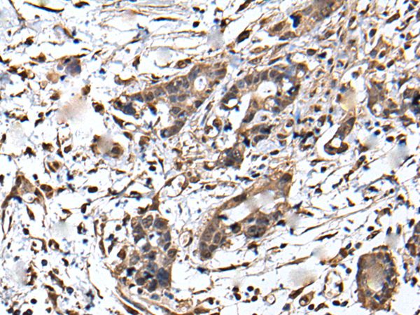 ZFP36 Antibody[43567]