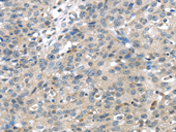 TRPM2 Antibody[42793]