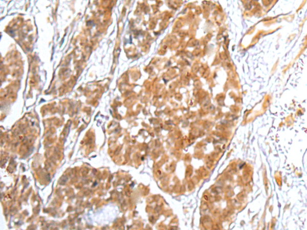 TRAPPC4 Antibody[42979]