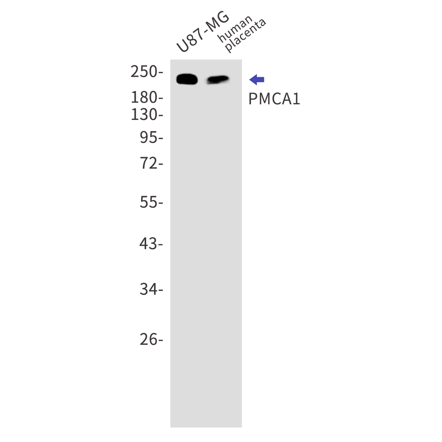 PMCA1 Rabbit mAb[52515]