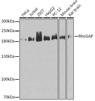 ARHGAP5 Rabbit Polyclonal Anti