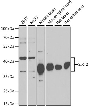 SIRT2 Rabbit Polyclonal Antibo
