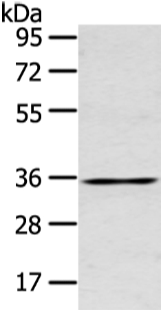 GJB5 Antibody[43239]