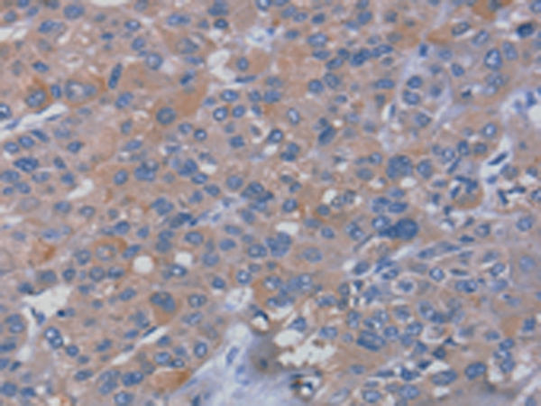 RHEB Antibody[42737]