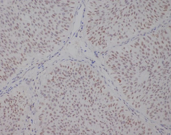 TFE3 Rabbit mAb[56400]