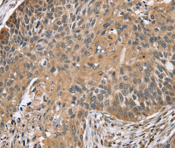 TRIM3 Antibody[37876]