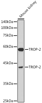 TACSTD2 Rabbit Polyclonal Anti
