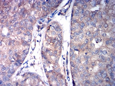 ASGR2 Mouse mAb[63093]