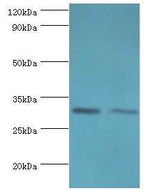 CLIC4 Polyclonal Antibody[4212