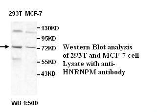 HNRNPM Antibody[39524]
