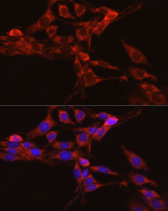 IRAK4 antibody[38750]