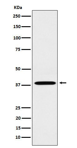 LTB4R Rabbit mAb[56973]