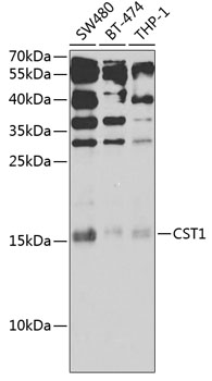 CST1 Rabbit Polyclonal Antibod