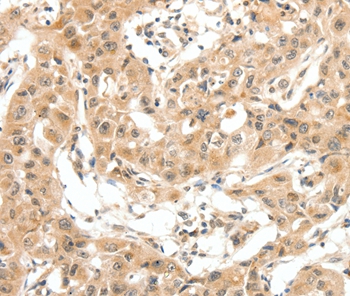 MAP3K14 Antibody[35838]