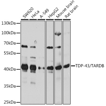 TARDBP Rabbit Polyclonal Antib