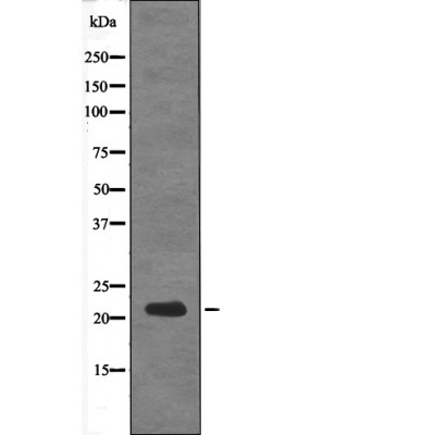 DSCR1 (Phospho-Ser108) Antibod