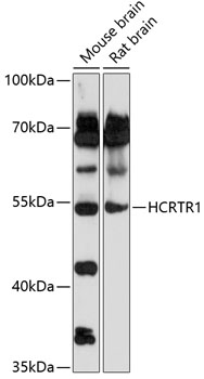 HCRTR1 Rabbit Polyclonal Antib