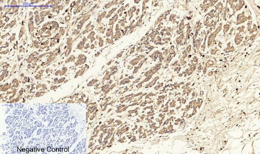 PKC Polyclonal Antibody[41347]