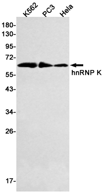 hnRNP K Rabbit mAb[52342]