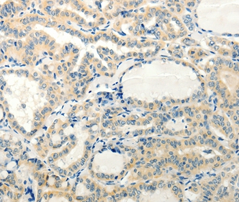 RXFP3 Antibody[37299]
