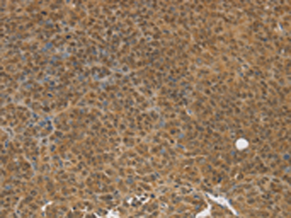 TGM7 Antibody[43168]