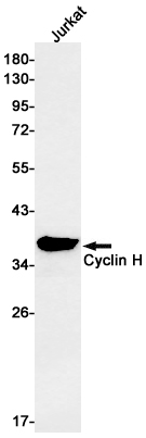 Cyclin H Rabbit mAb[52238]