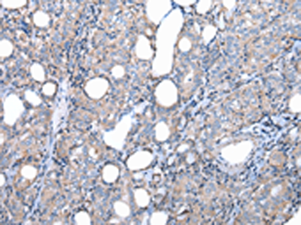 FKBPL Antibody[42860]