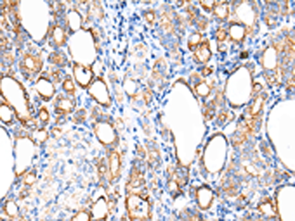 KRT7 Antibody[43217]