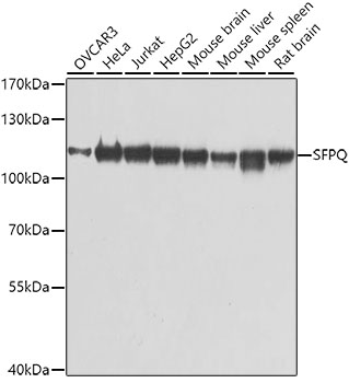 SFPQ Rabbit Polyclonal Antibod