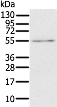 RORB Antibody[37880]