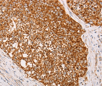 AK2 Antibody[36210]