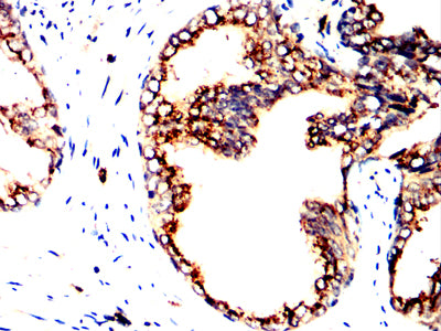 PPID Mouse mAb[64112]