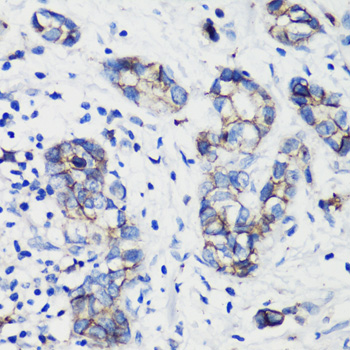E-Cadherin Rabbit Polyclonal A