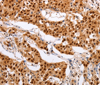 PSMD8 Antibody[35895]