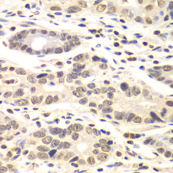 CCNC antibody[38997]