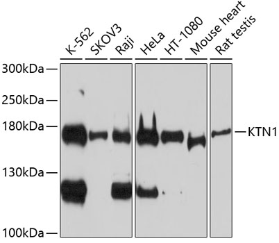 KTN1 Rabbit Polyclonal Antibod