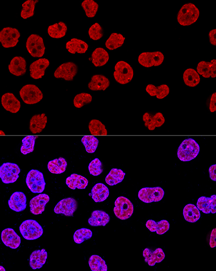 KHDRBS1 Rabbit Polyclonal Anti