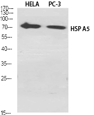 HSP A5 Polyclonal Antibody[410
