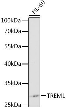 TREM1 antibody[38127]