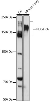 PDGFRA antibody[38364]