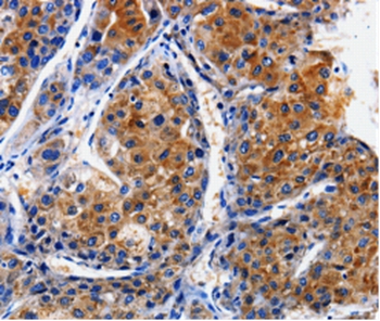 CLCA4 Antibody[35684]