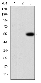 MMP-9 Monoclonal Antibody[4918