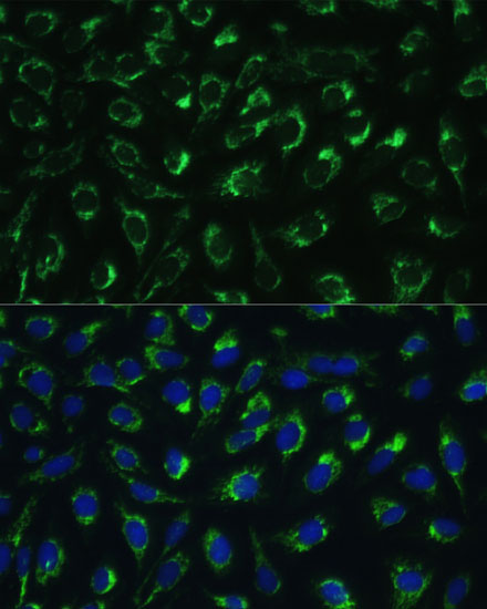 MTIF2 Rabbit Polyclonal Antibo