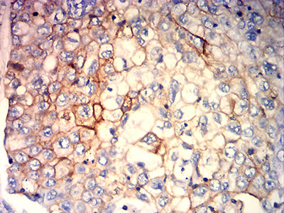 HLA-C Mouse mAb[63732]