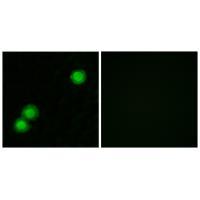 IPKB Antibody[34054]