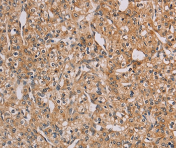 CHRNA4 Antibody[35829]