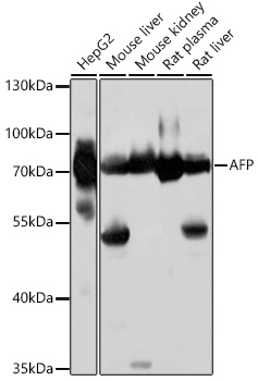 AFP Rabbit Polyclonal Antibody