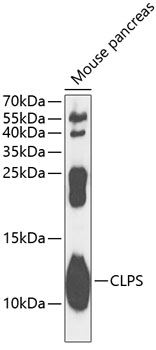 CLPS Rabbit Polyclonal Antibod