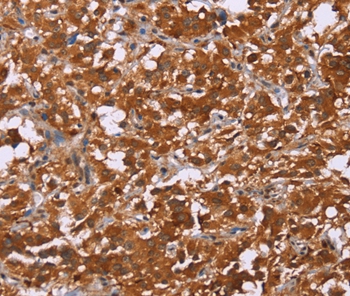 DCBLD2 Antibody[36401]